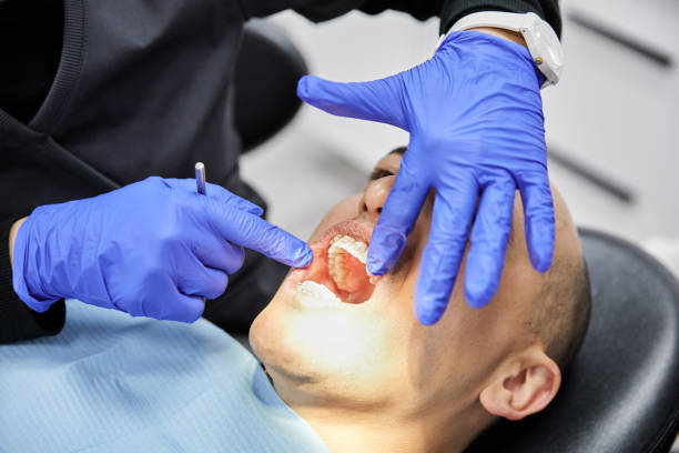 Best Broken or Chipped Tooth Repair in Lake Holiday, IL